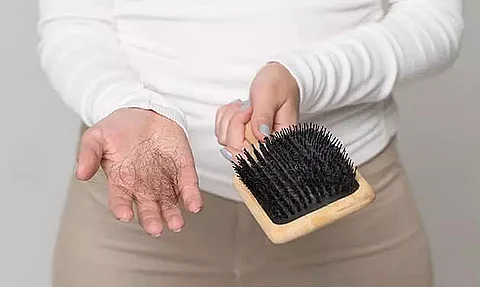 Tips to Control Hair Fall Post COVID Recovery