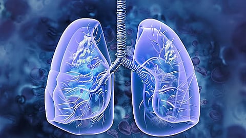'Air Pollution May Trigger Lung Cancer In Non-Smokers'