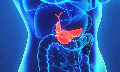 Know about gall bladder stone and laparoscopic surgery
