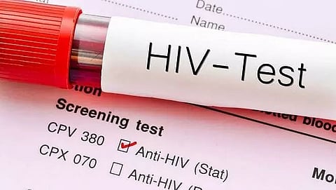 Kamrup (M) tops the list of HIV prevalence in Assam