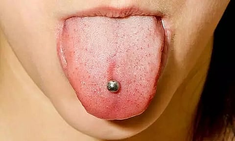 Oral piercings - A Dental Health Hazard