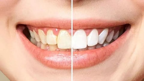 Debunking Common Myths About Fluoride: What You Need to Know for Better Dental Health