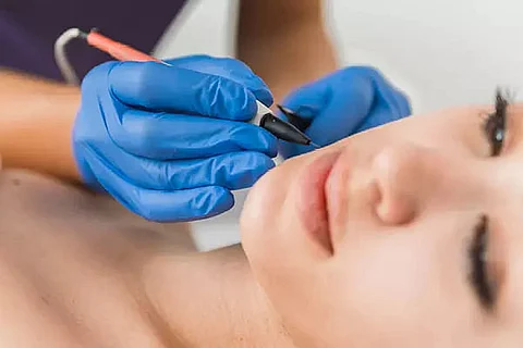 Get Rid of Unwanted Hair with Best Methods for Hair Removal