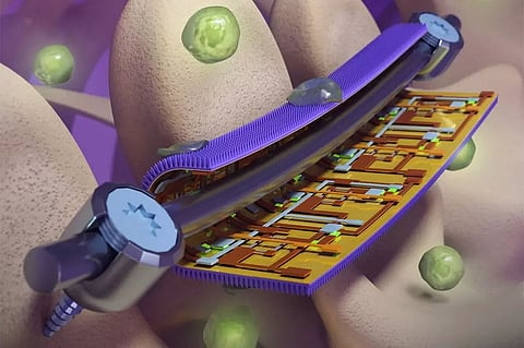 New smart surgical implant coatings can warn implant failure, cut infection