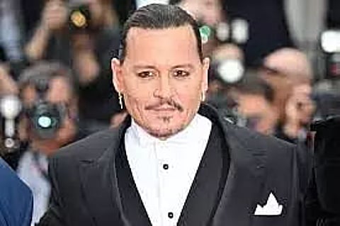 Johnny Depp says he’s ‘proud’ of his ‘rotting teeth’ with ‘loads of cavities’