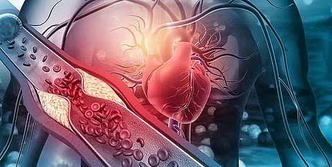 Drivers of heart disease