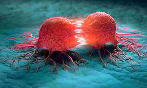 Cancer on the rise in Northeast India