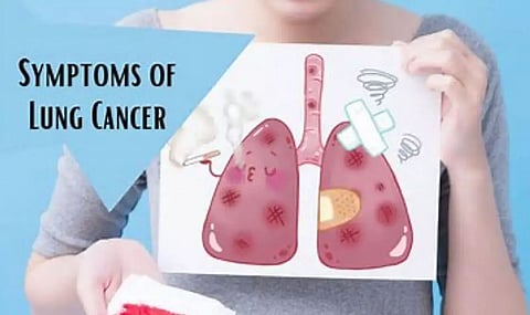 Lung cancer continues to top Cancer mortality charts in India