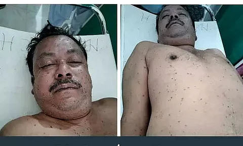 Assam: One dead and nine injured in bee swarm attack in Morigaon town