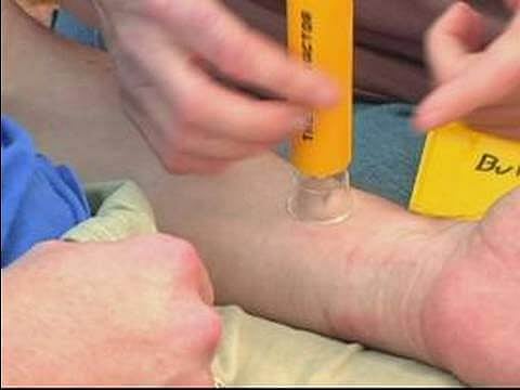 Doctors save life of man bitten by viper