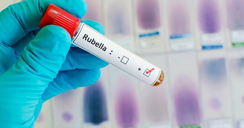 Workshop on Measles Rubella Vaccination Campaign held at Ampati, Shillong