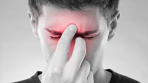 3 Causes of Sinusitis That Nobody Told You About