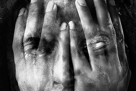 Acid Attack: Lakhimpur Police Arrest Papu Borah and Debojit Pathak