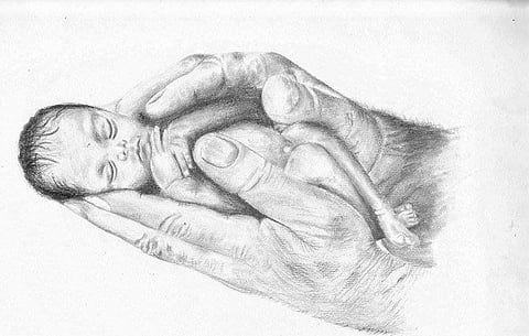 Gynaecologists march to ‘Save Girl Child’