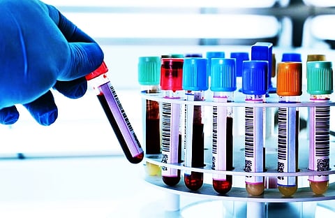 Free clinical laboratory services introduced in Tripura