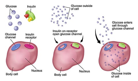 Myths about Diabetes Care and Cure