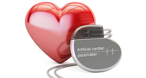 India’s Drug Controller Issues Advisory Against Medtronic’s Astra Pacemakers