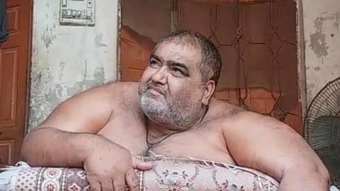 Pakistan’s heaviest man dies unattended in ICU after a successful liposuction surgery