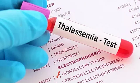 Lecture Programme on Thalassemia held in Tinsukia Bangiya Vidyalaya HS School