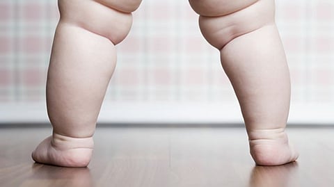 ‘Only child’ 7 times more likely to be obese: Researchers