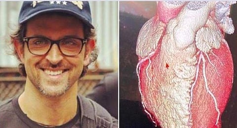 Bollywood Actor Hrithik Roshan shares the shape of his heart