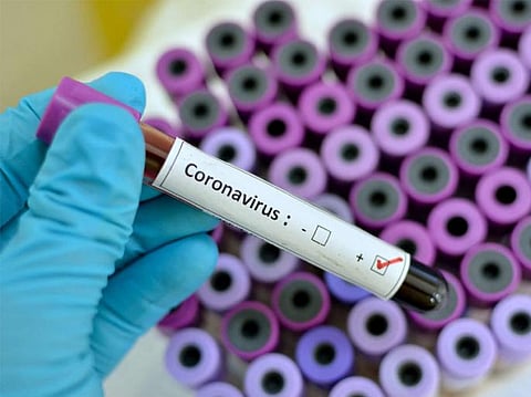 China confirms 830 coronavirus cases, 25 deaths