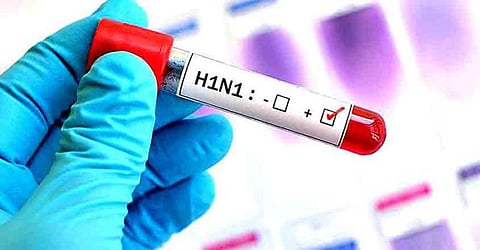 5 test positive for H1N1 in Kerala village; no worry, says Health Officials