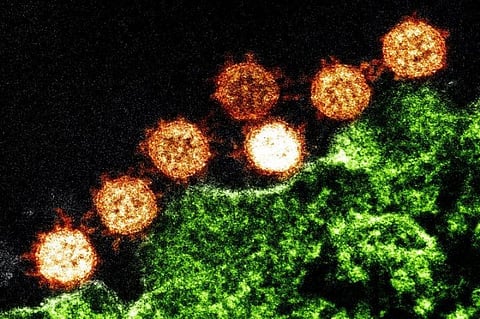 Coronavirus update: Twitter users post unhygienic pics of quarantine facility