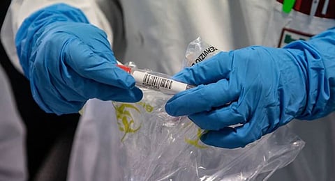 Indian-origin team of researchers develops test to spot corona infection in 2 hours