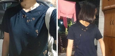 Delhi police books man who spat on Manipuri woman and called her “corona”