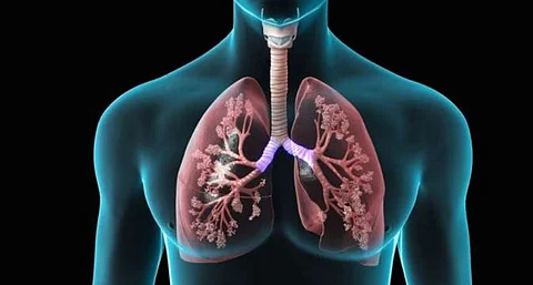 How Corona-recovered patients can improve Lung function?