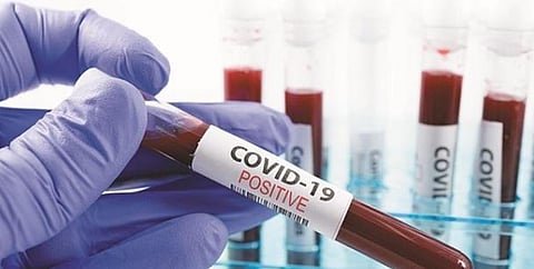 First COVID-19 positive case detected in Dhubri district
