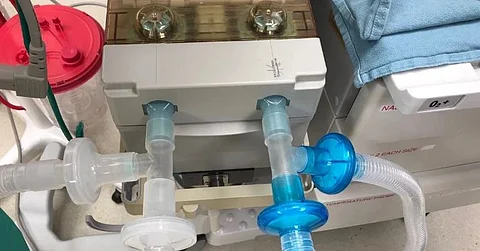 This startup leads India’s race to build low-cost ventilators