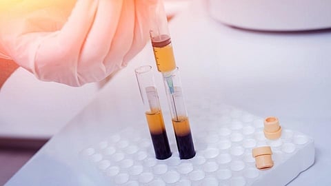 Video - कोरोनामुक्तीसाठी प्लाझ्मादान गरजेचे; दानशूरांची संख्या कमी