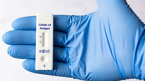 RT-PCR चाचणीचे रिपोर्ट निगेटिव्ह का येतात?