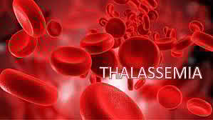 thalessemia