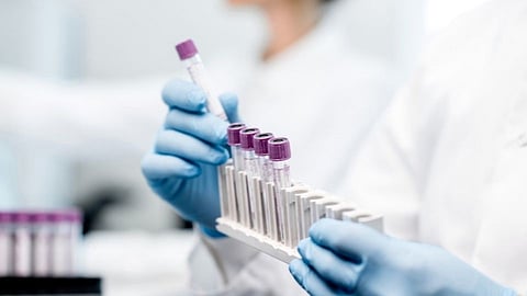 कोविड तपासणीत हलगर्जीपणा; 20 लॅबना दणका