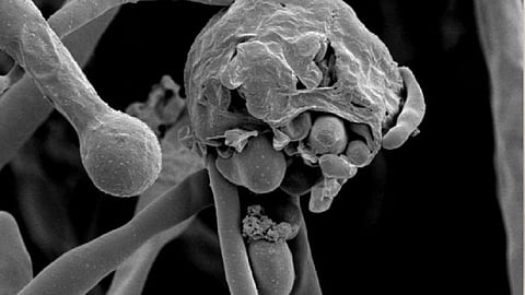 म्युकरमायकोसिसला महामारी घोषित करा; केंद्राचे राज्यांना आदेश