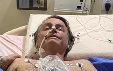 दहा दिवसांपासून उचक्या थांबेनात; ब्राझिलचे राष्ट्राध्यक्ष रुग्णालयात