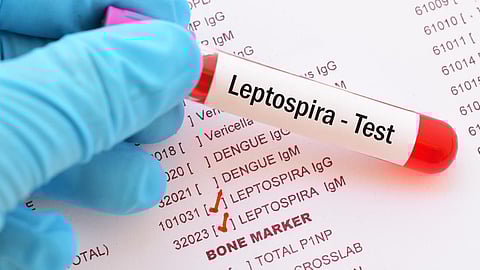 पावसाळ्यात घ्या ‘लेप्टो’ची खबरदारी