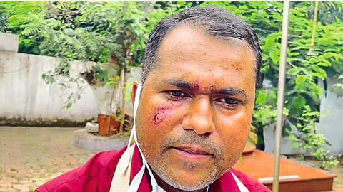 वाळूज (जि.औरंगाबाद) : मारहाणीत जखमी झालेले गणेश कोटींगचे व्यवस्थापक शिरीष राजेभोसले.