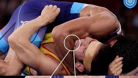 VIDEO: आखाड्यात 'दंगल'; प्रतिस्पर्ध्याचा भारतीय पैलवानाला चावा