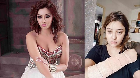 अभिनेत्री पायल घोषवर रॉडने हल्ला; अॅसिड फेकण्याचा केला प्रयत्न