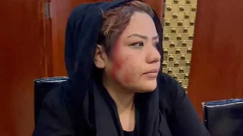 मारहाण झालेल महिला राबिया सादात