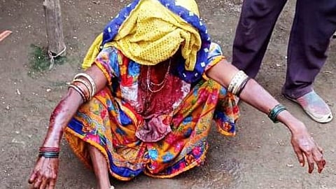 अस्वलाच्या हल्ल्यात वृद्धेचा फुटला डोळा अन् गंभीर जखमा