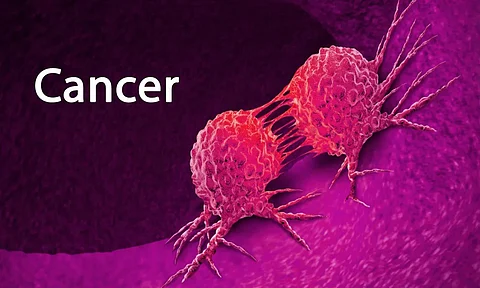 Breast cancer surge in Maharashtra: 36 lakh women screened