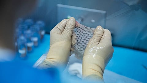 Belgaum : केएलईतील ‘स्किन बँक’ पुन्हा सुरू