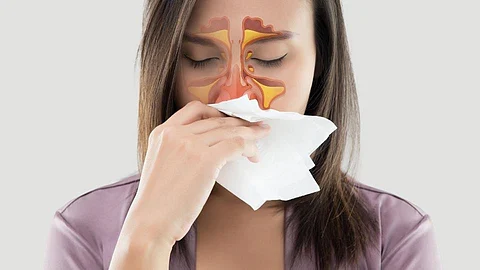 Sinus Infection: हिवाळ्यात ही 3 लक्षणे असू शकतात सायनसची