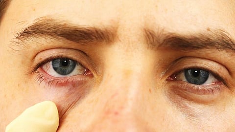 STD symptoms: डोळ्यातून दिसतात आजाराची सुरुवातीची लक्षणं