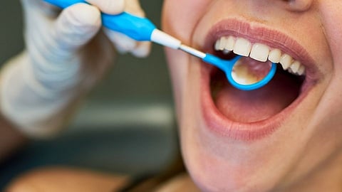 World Oral Health Day 2022